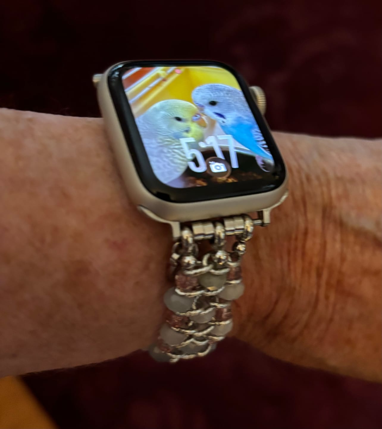 Customer photo review of Moonkissed Astral Glow Braided Apple Watch Strap