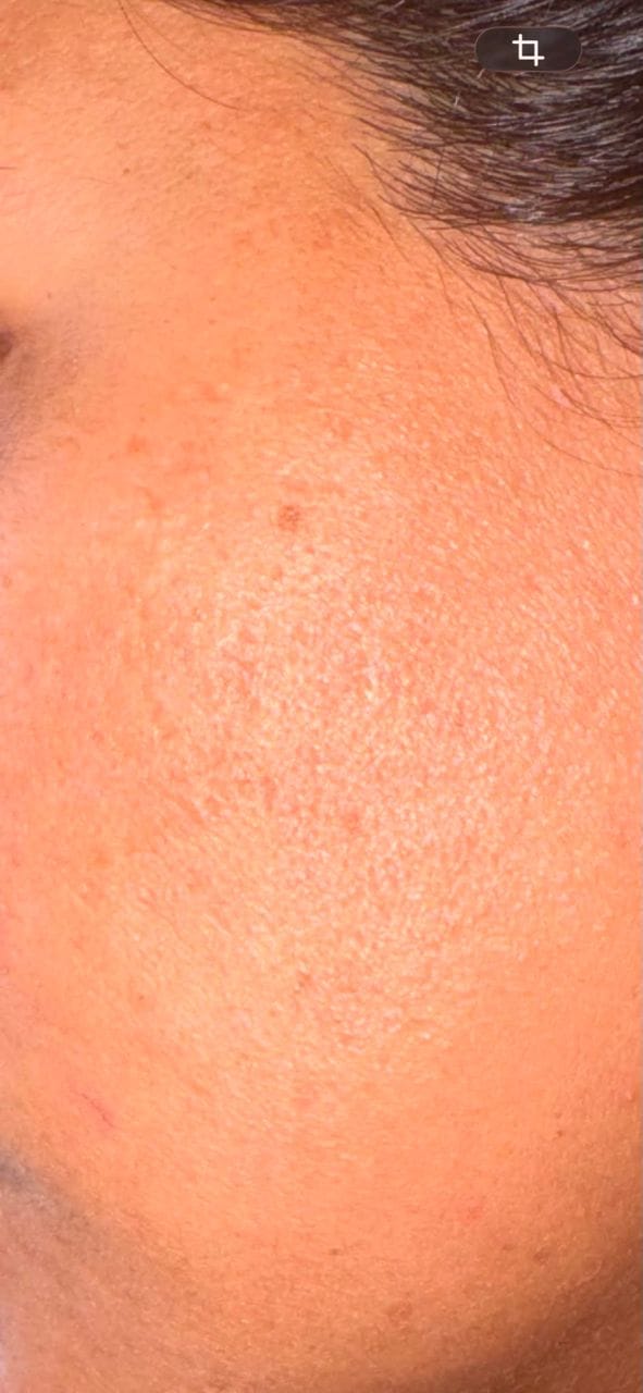 Customer photo review of Gel Nettoyant Purifiant Visage