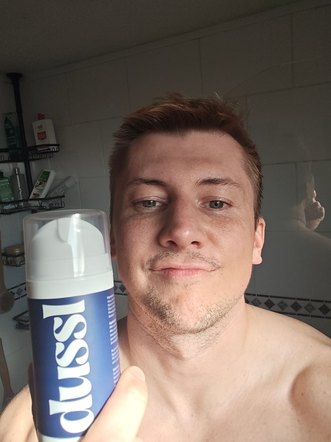 Customer photo review of Calming After Sun Gel