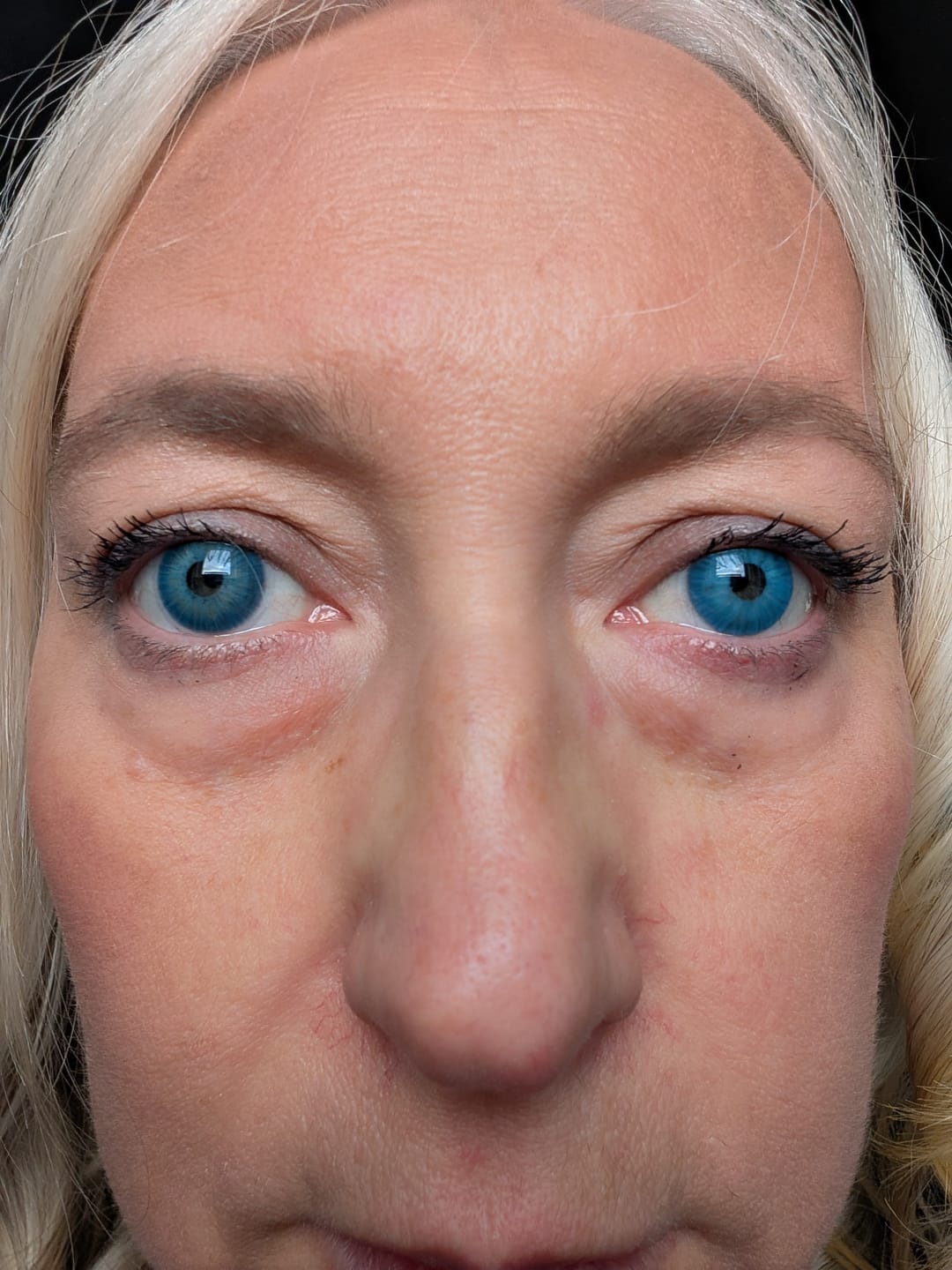 Customer photo review of Amazonia Antarctic Blue Prescription Coloured Contact Lenses