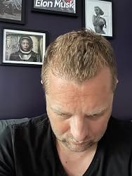 Customer photo review of Hair Control - Shampoo Anticaída