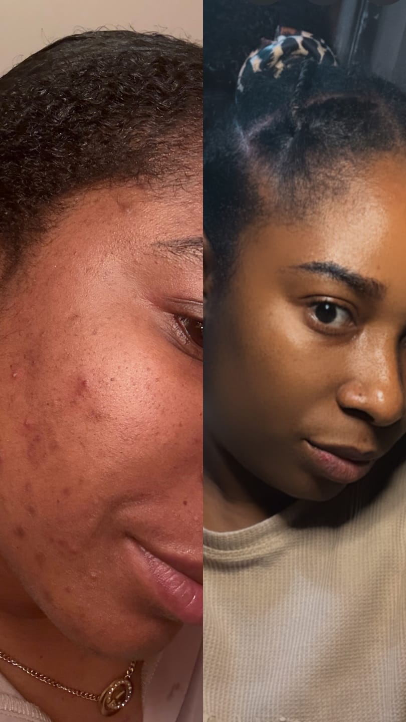 Customer photo review of Turmeric and Kojic Foaming Face Wash