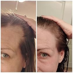 Customer photo review of Hair Control - Shampoo Anticaída