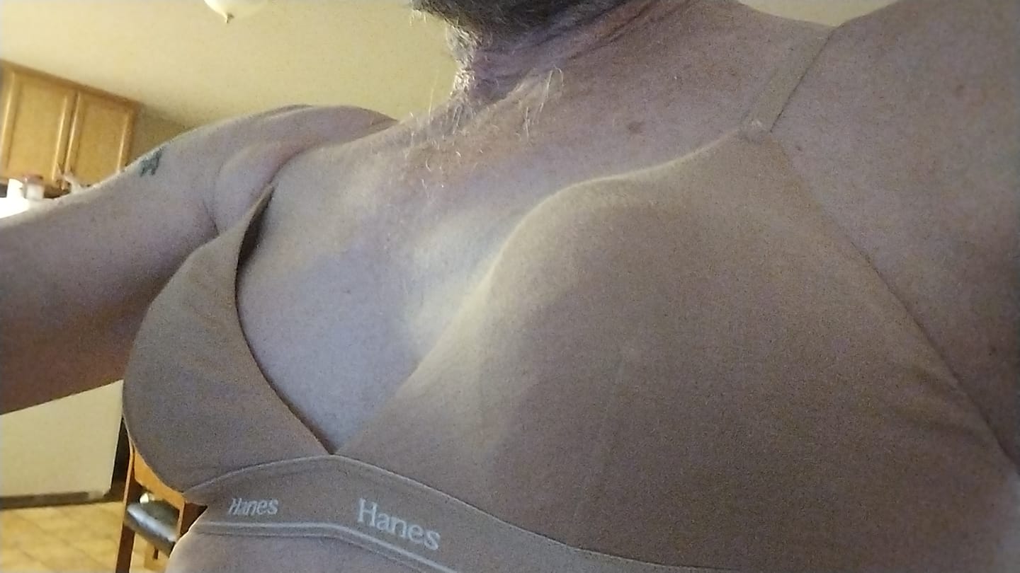 Customer photo review of L-shaped Bra Inserts
