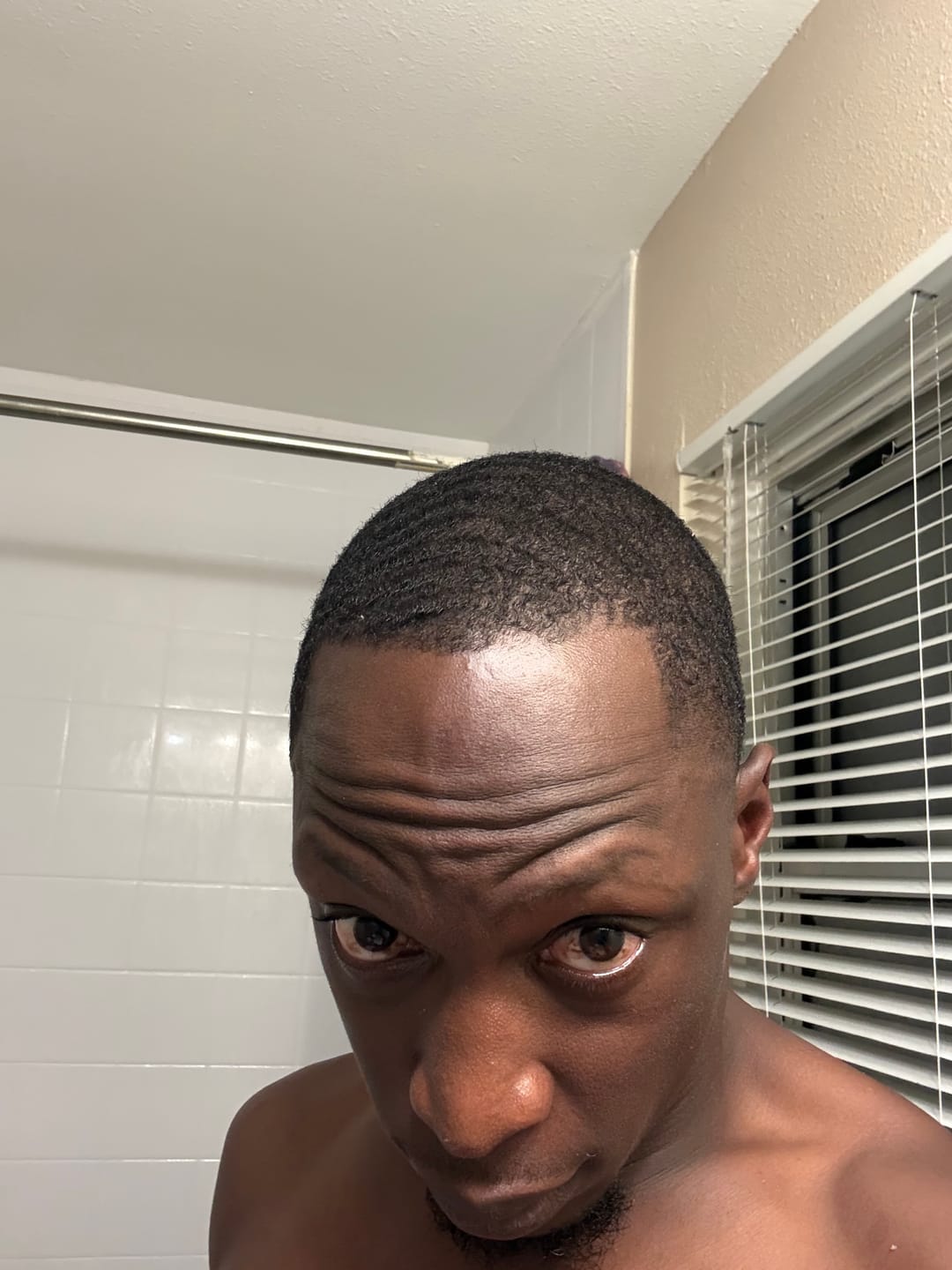 Customer photo review of Natural DHT Blocker