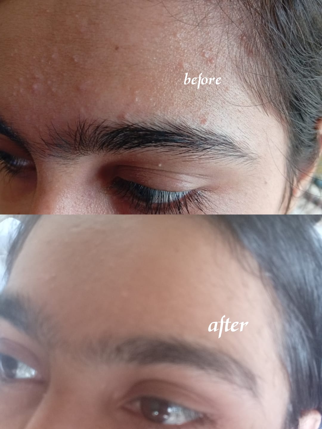 Customer photo review of Glow Bundle: Brightening Duo