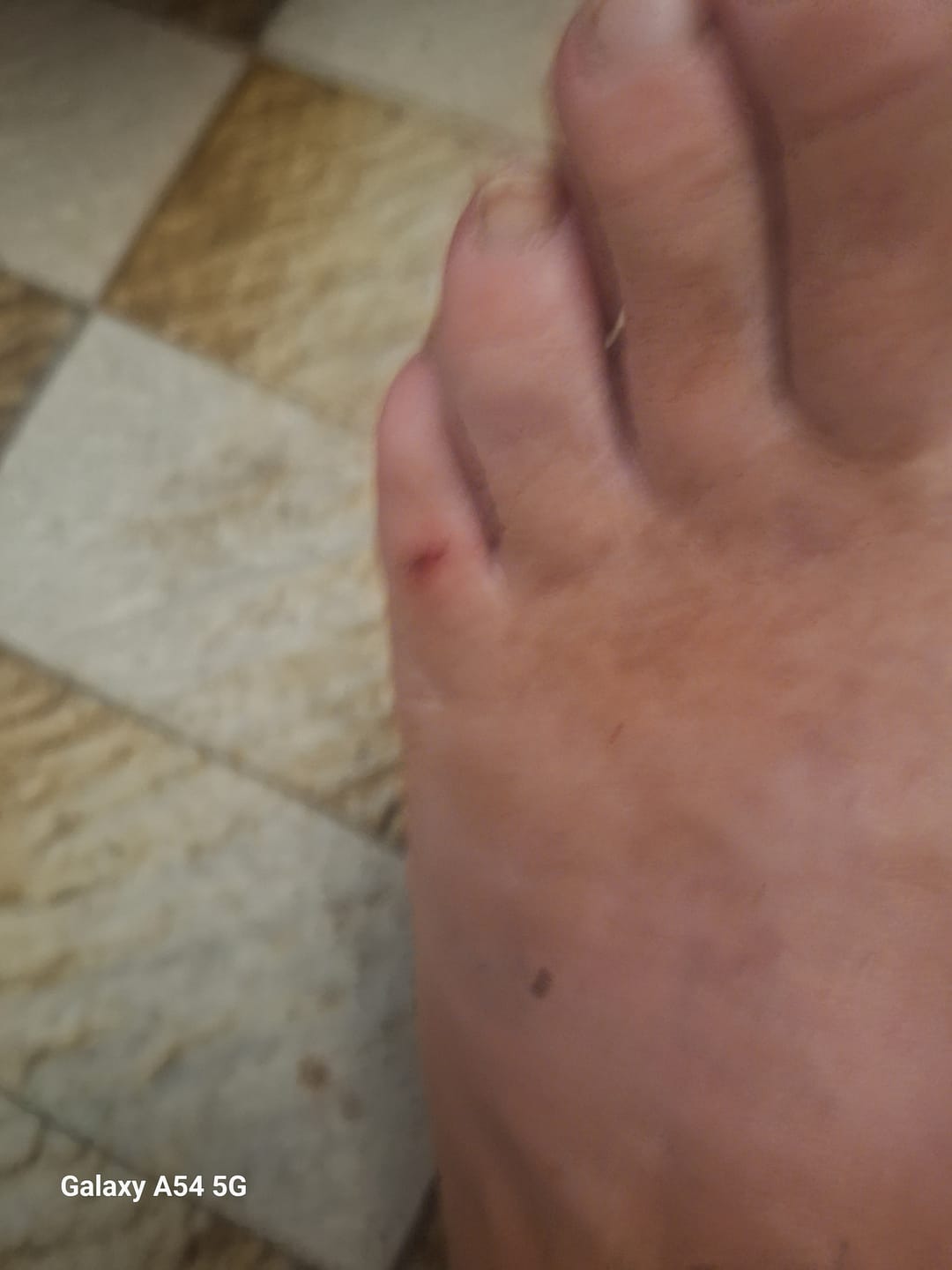 Customer photo review of WolfPaw - Scarpe Barefoot