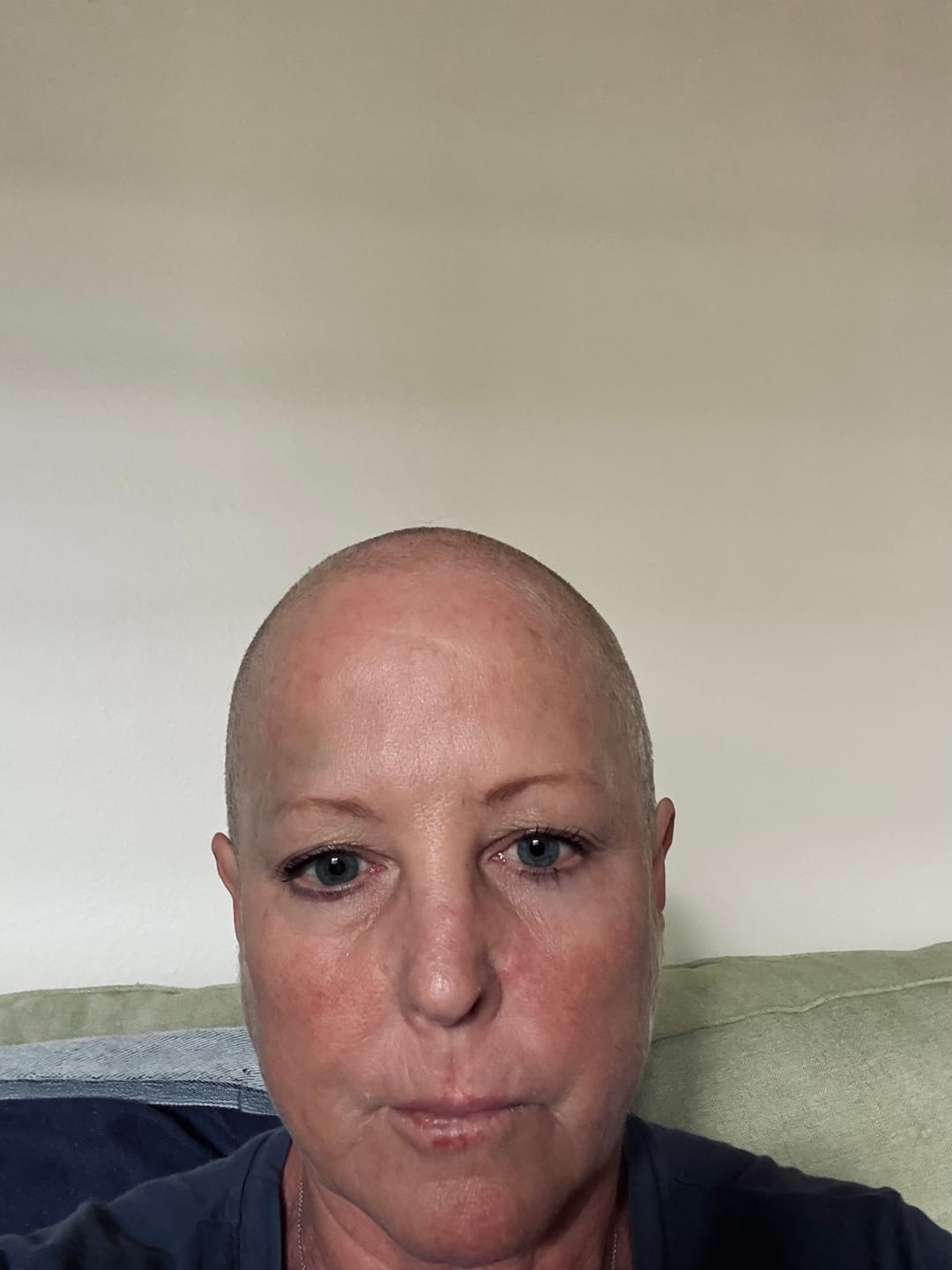 Customer photo review of Face Cream For Chemo Patients