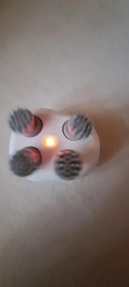 Customer photo review of Electric Hair & Scalp Massager