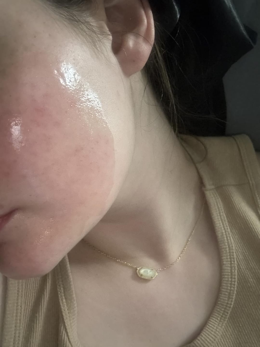 Customer photo review of Kojic Acid Turmeric Night Wrapping Mask ℗