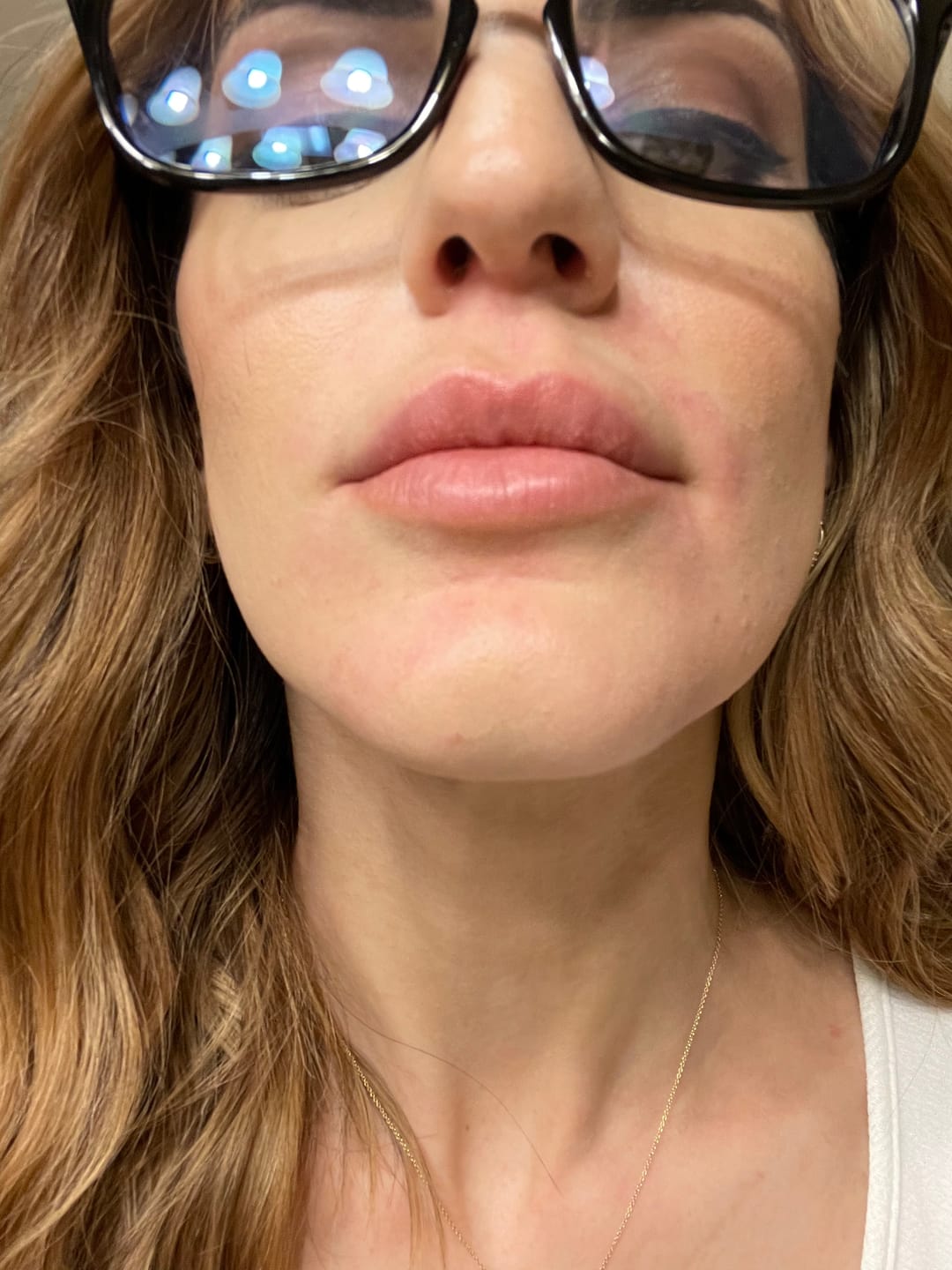 Customer photo review of Silicone Led Light Therapy Mask