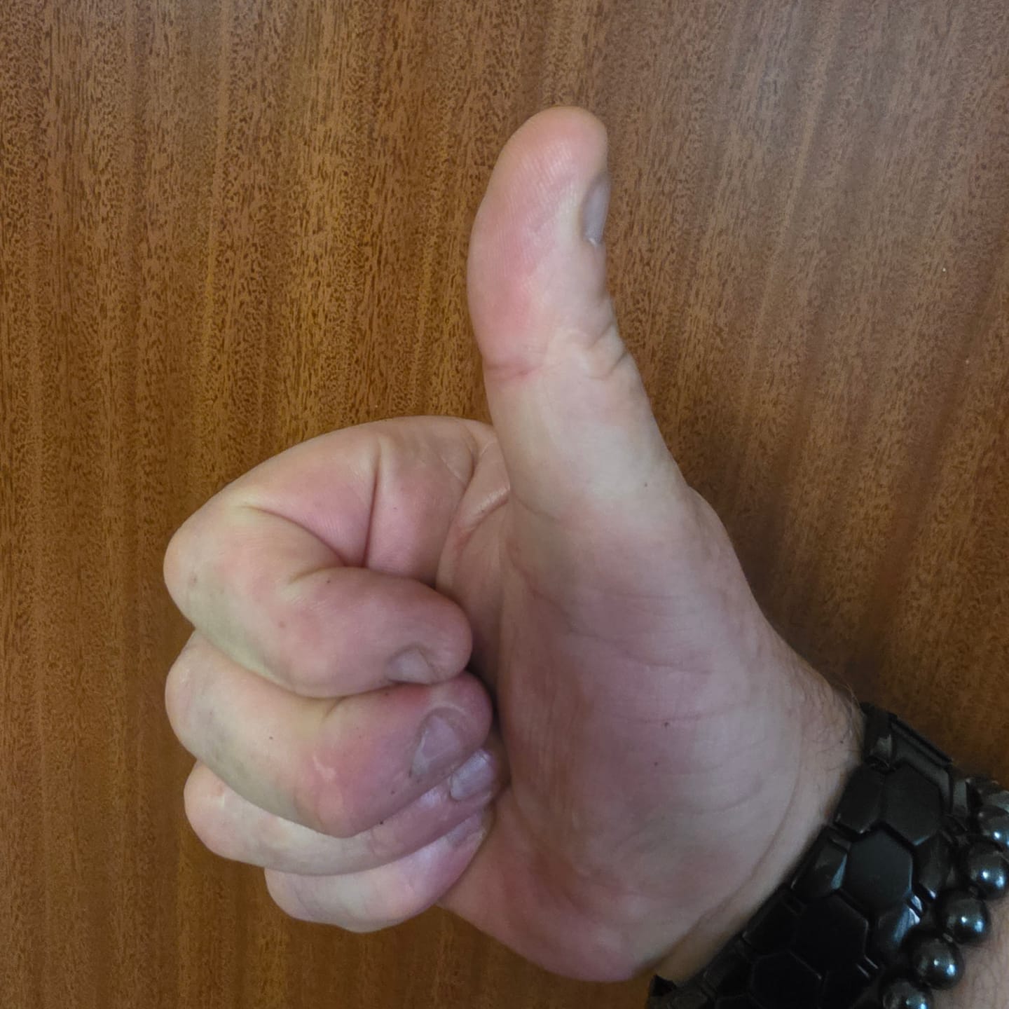 Customer photo review of Shipping Protection