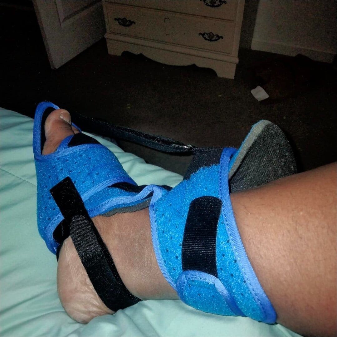 Customer photo review of Night Splint for Plantar Fasciitis
