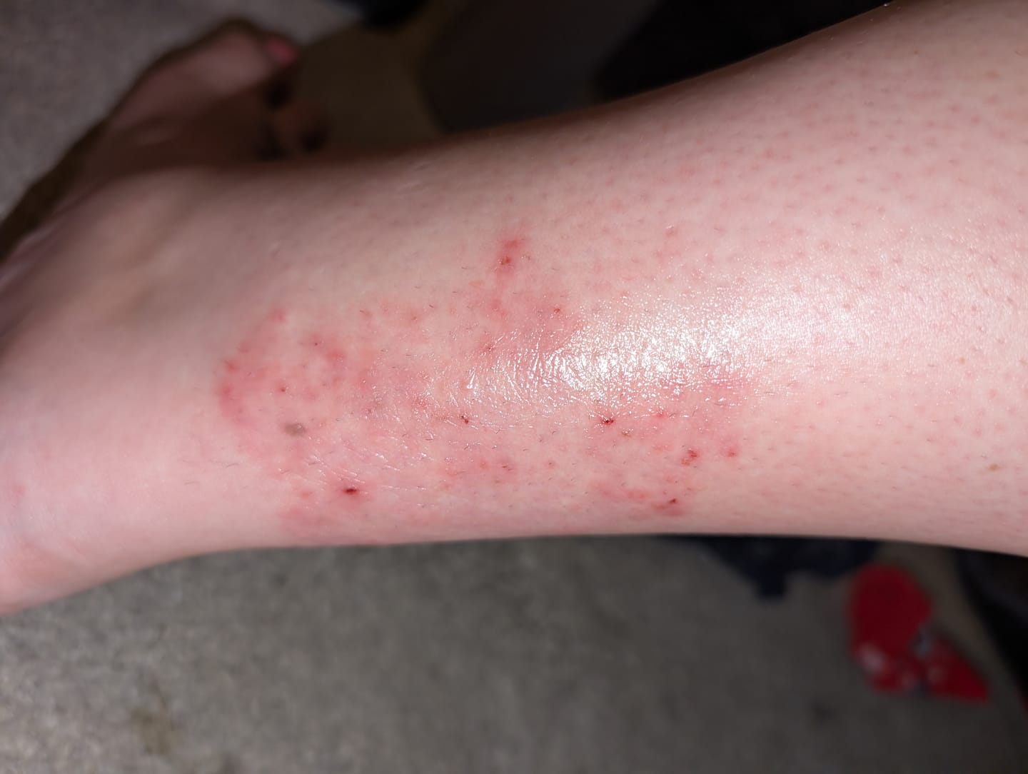 Customer photo review of Seb Natural Calming Serum