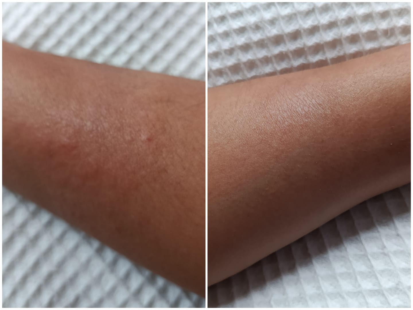 Customer photo review of Crema corporal con Lulo, Uchuva y Maracuya