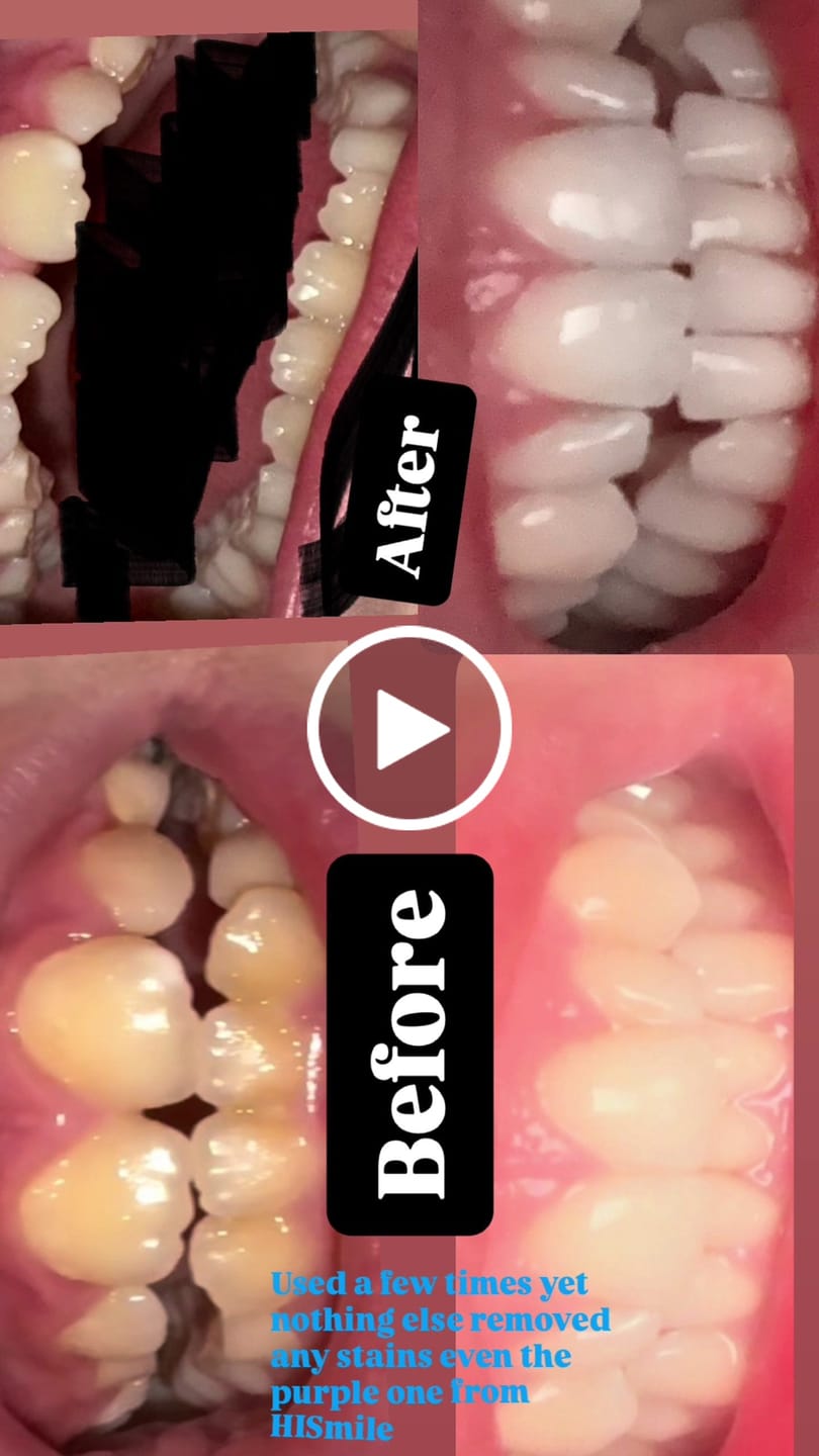 Customer video review of Powder & Strips Duo