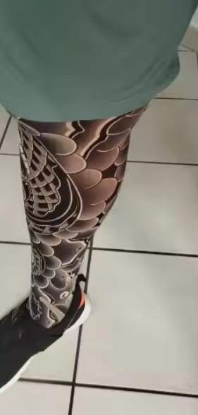 Customer photo review of Tatelio® - Invisible Tattoo Mesh