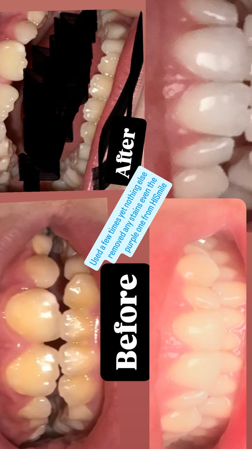 Customer photo review of Mini & Me Toothpaste Bundle