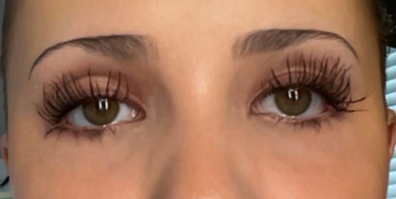Customer photo review of Eyelash Growth Serum