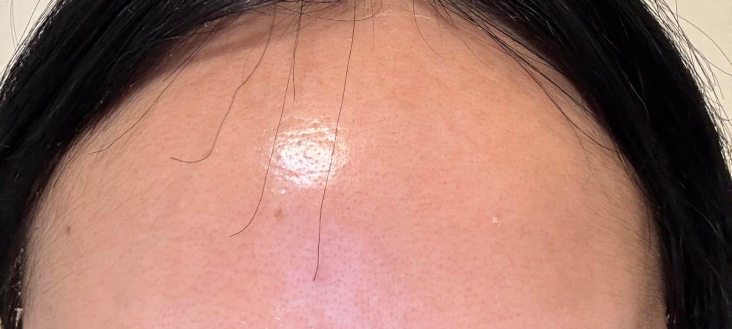 Customer photo review of Kojic Acid Turmeric Night Wrapping Mask ℗