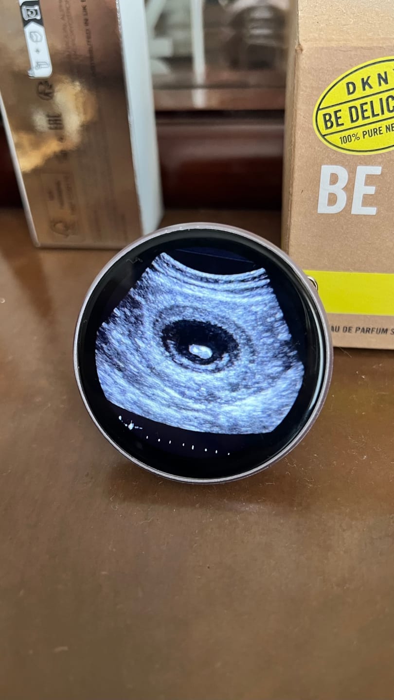 Customer photo review of TinyLove™ A primeira memória do teu bebé