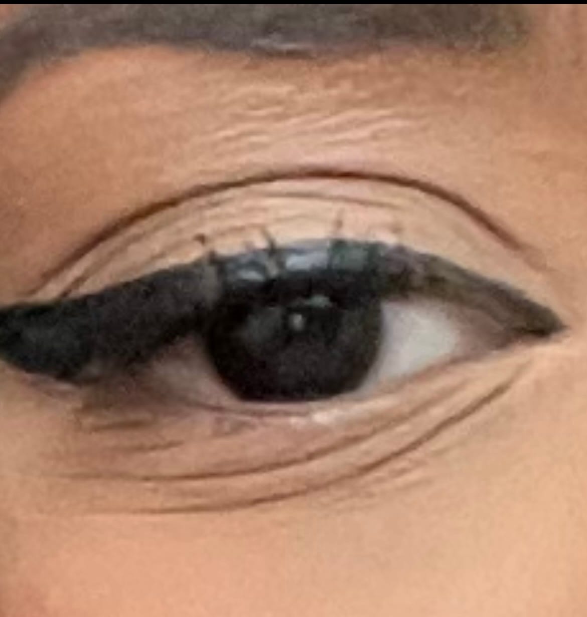 Customer photo review of Beautronics Under Eye Skincare Wand