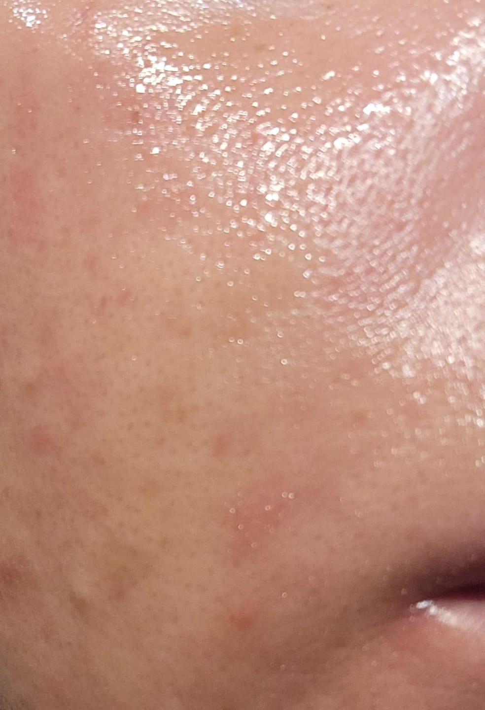 Customer photo review of Kojic Acid Turmeric Night Wrapping Mask ℗