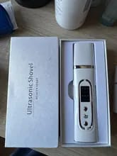 Customer photo review of Ultrasonic Skin Scrubber Facial Pore Cleanser