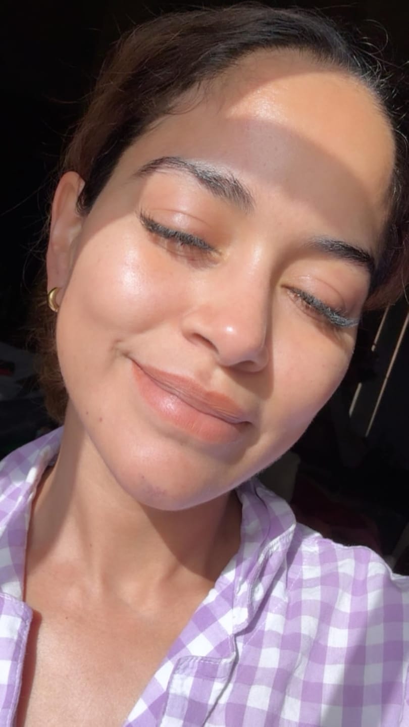 Customer photo review of Tosowoong Arbutin Brightening Cream