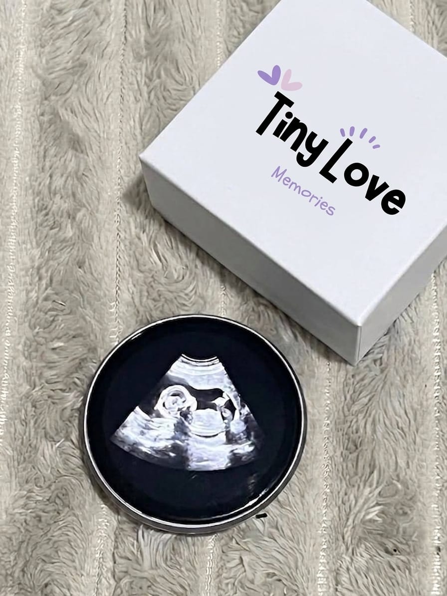 Customer photo review of TinyLove™ A primeira memória do teu bebé