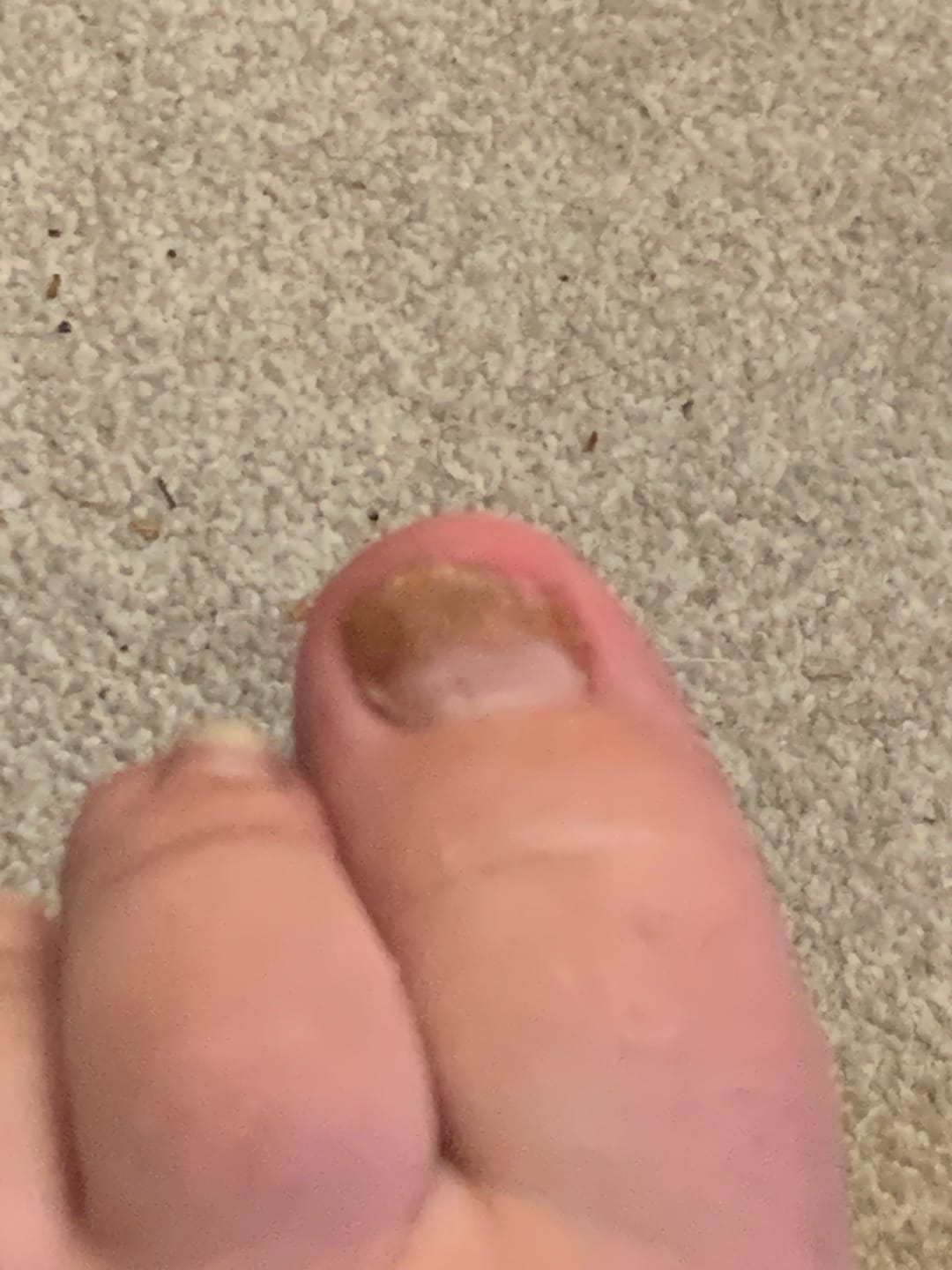 Customer photo review of Fungal Freedom