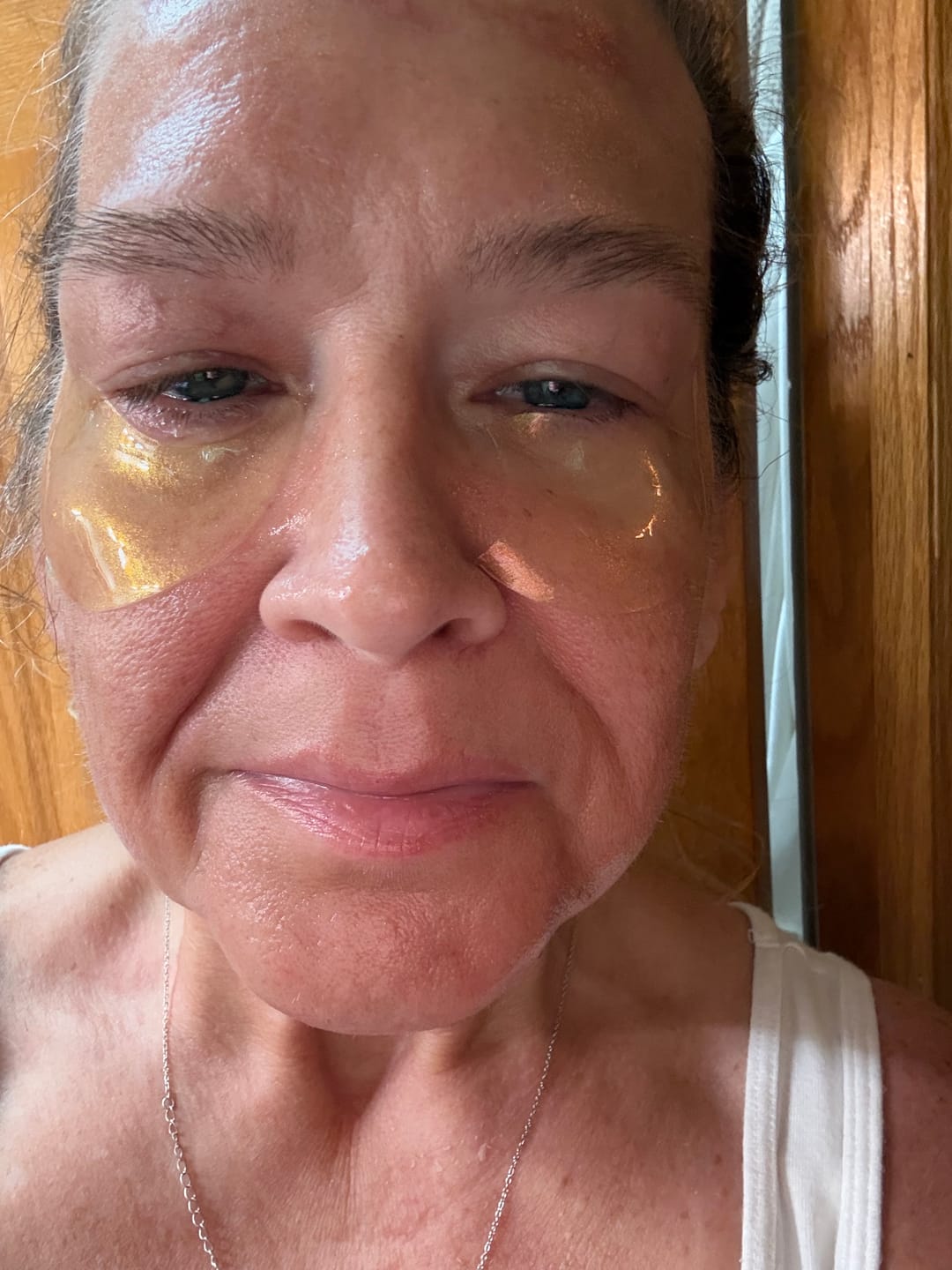 Customer photo review of 24K Gold Collagen ++ Firming Eye Gels