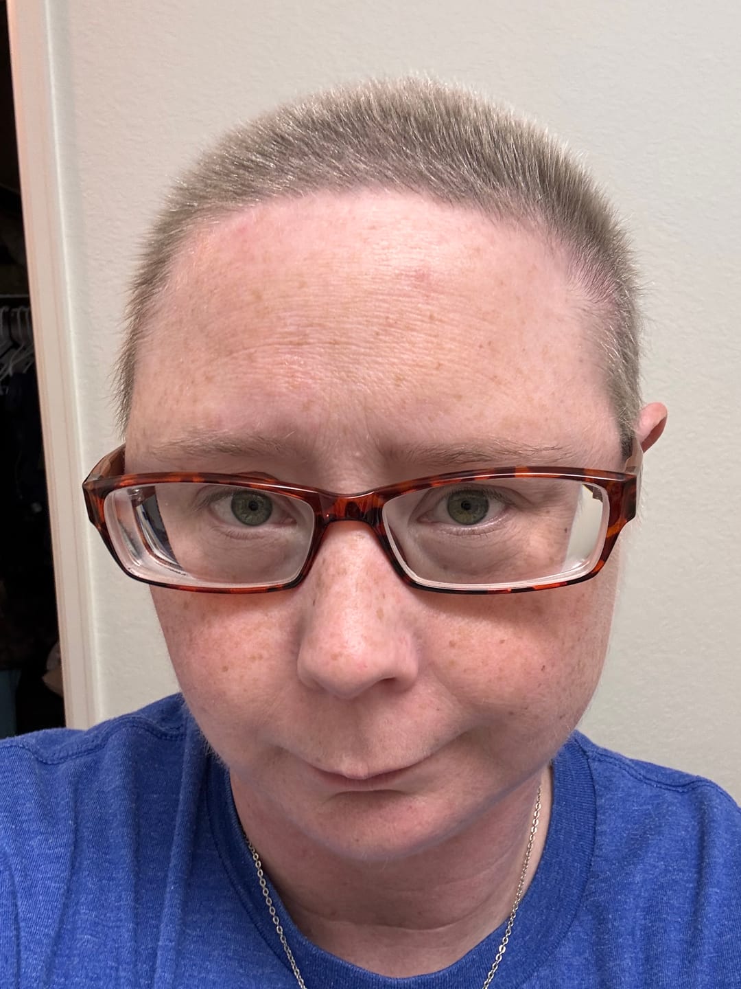 Customer photo review of Hair Growth Hero Bundle