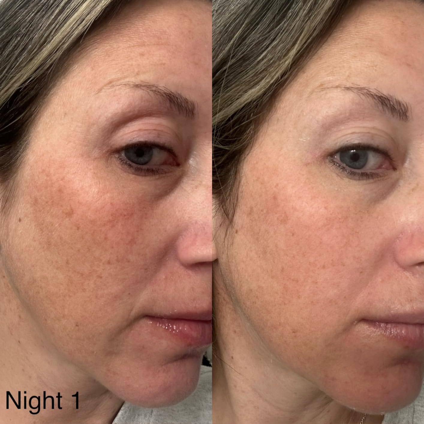 Customer photo review of Kojic Acid Turmeric Night Wrapping Mask ℗