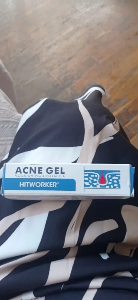 Customer photo review of Avenza™ Gel Anti-Acné