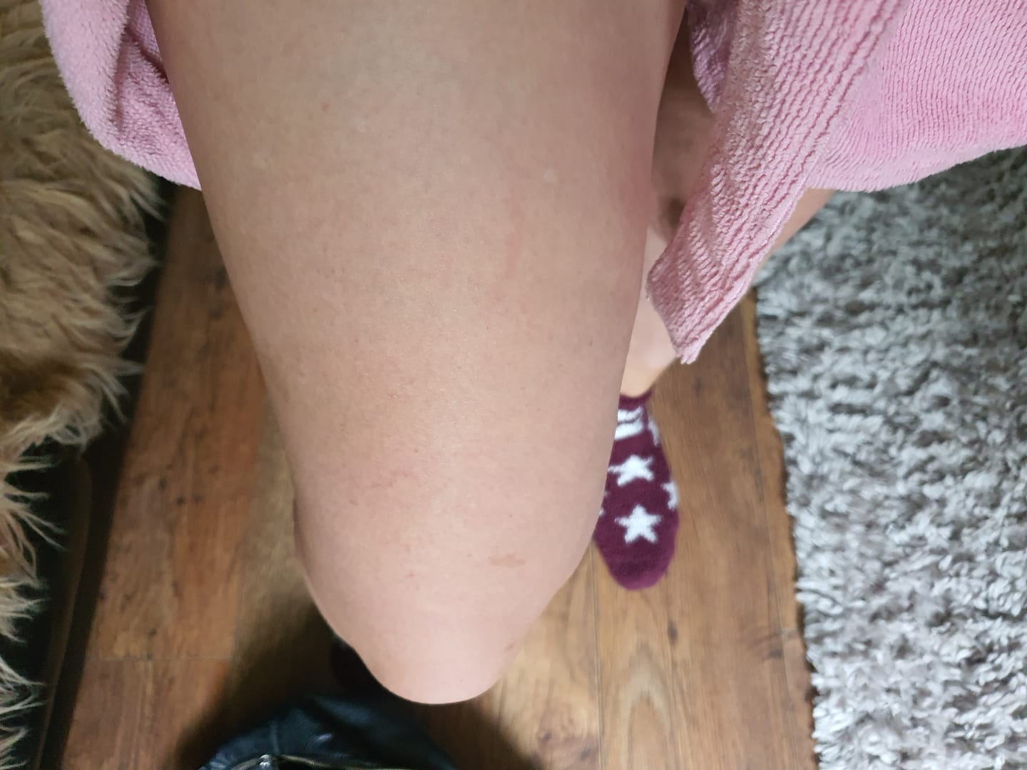 Customer photo review of Body For Us Anti-Cellulite Massage Oil