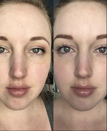 Customer photo review of Glow + Immunity Marine Collagen