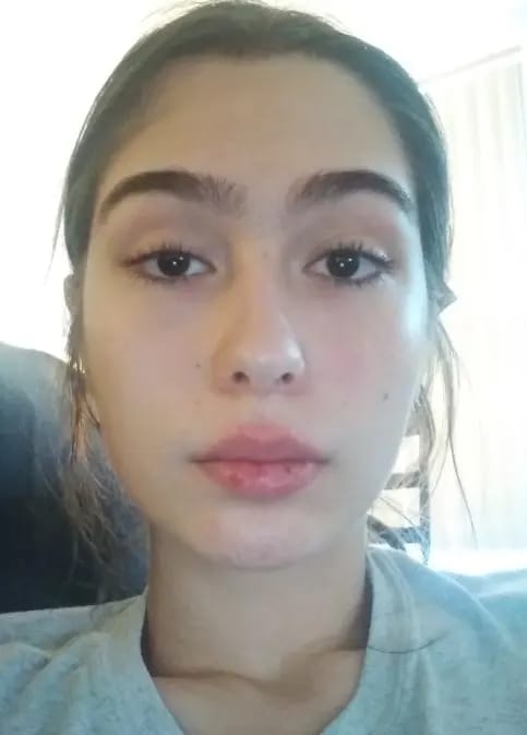 Customer photo review of Laesera Aloë Vera Gel