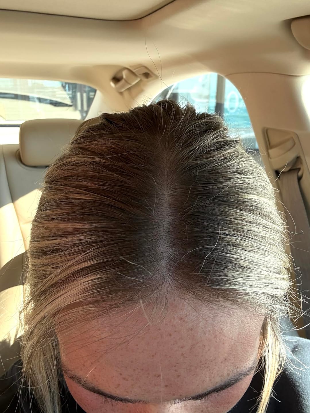 Customer photo review of Koreas #1 Hair Growth Serum