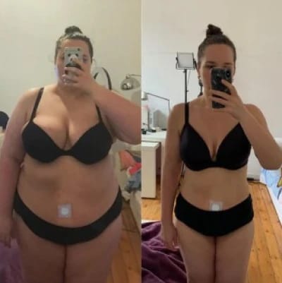 Customer photo review of Slimpatch — La solución que tu cuerpo estaba esperando
