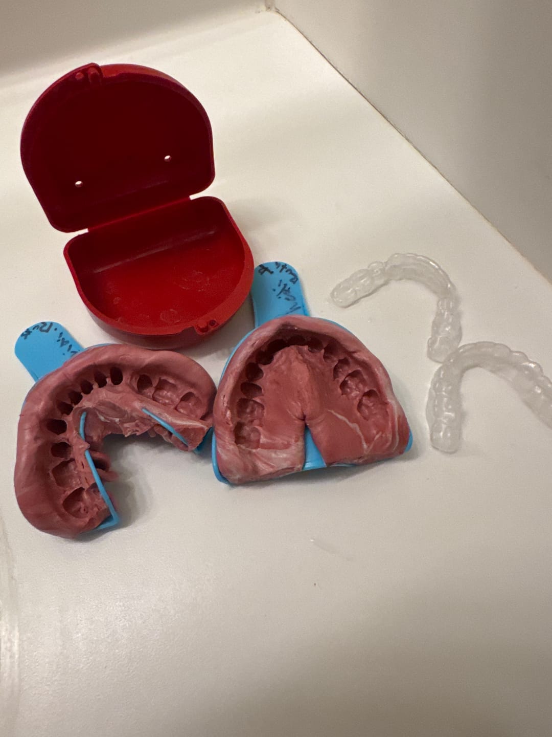 Customer photo review of Impression Kit