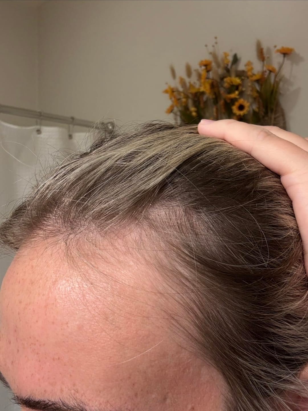 Customer photo review of Koreas #1 Hair Growth Serum
