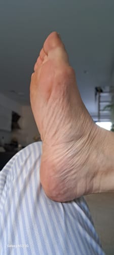 Customer photo review of ALMALILA™ Lima Eléctrica – Pies Suaves y Lisos