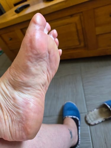 Customer photo review of ALMALILA™ Lima Eléctrica – Pies Suaves y Lisos