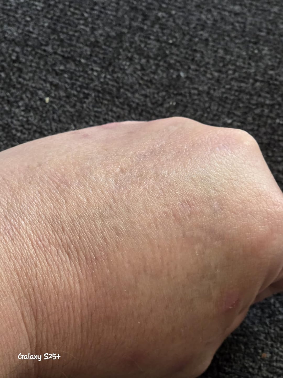 Customer photo review of CeraVe Invisible Mineral Sunscreen