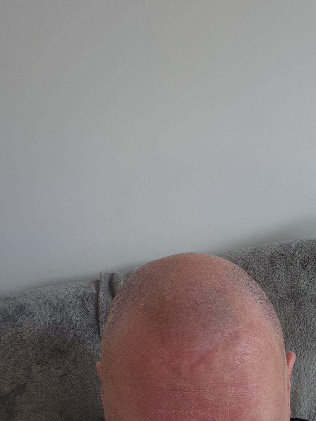 Customer photo review of Seb Natural Calming Serum
