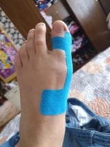 Customer photo review of OrthoFlex™ – Fita para Hálux Valgo