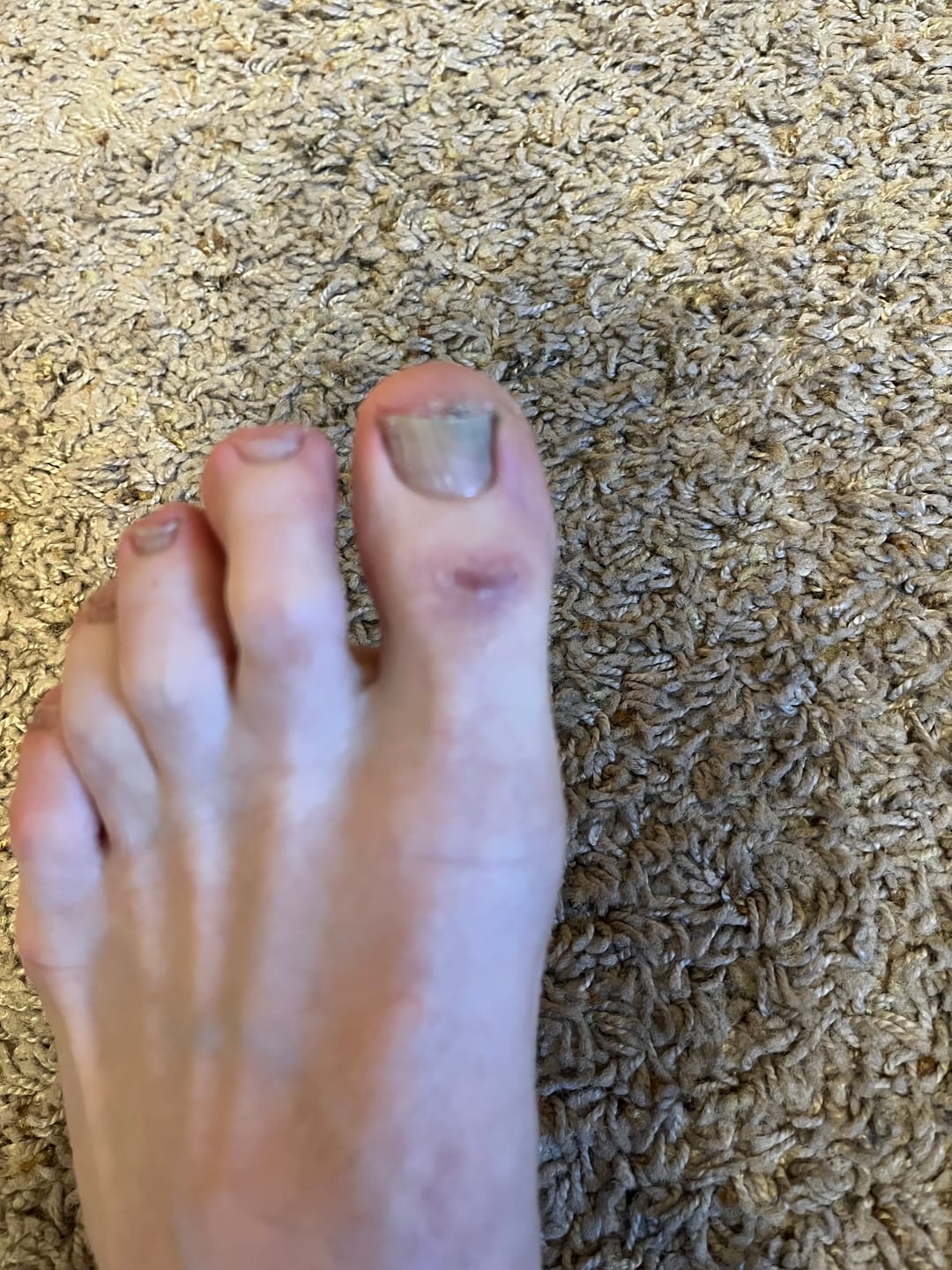 Customer photo review of Aurora - Wide Toe Sneakers