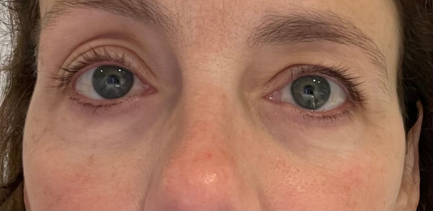 Customer photo review of BRIGHT & TIGHT UNDER EYE CREAM