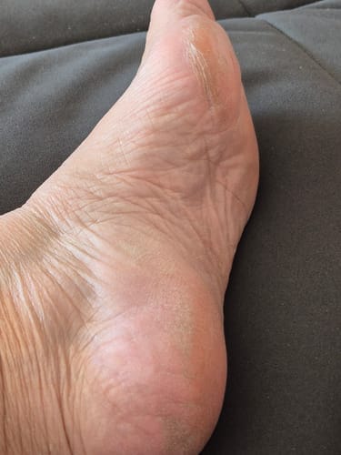 Customer photo review of ALMALILA™ Lima Eléctrica – Pies Suaves y Lisos
